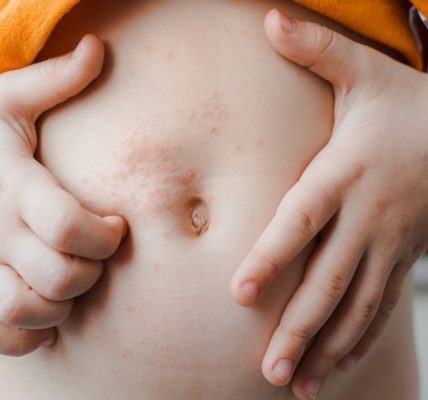 Generalmente los casos de varicela son un cuadro benigno, pero en algunos casos puede evolucionar a neumonía, meningitis o incluso, llevar a la muerte