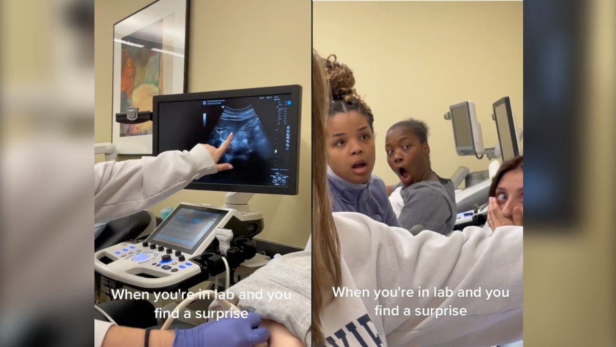 El video viral en cuestión captura un momento peculiar entre las estudiantes durante una práctica de ecografía